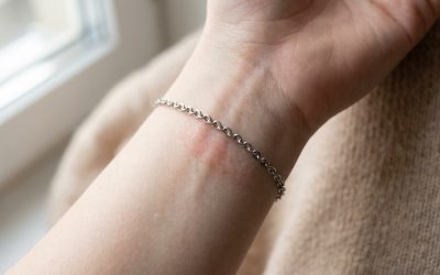 Acier inoxydable et allergie : le faux ami de votre peau